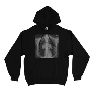 "X-Ray" Basic Hoodie Black/White